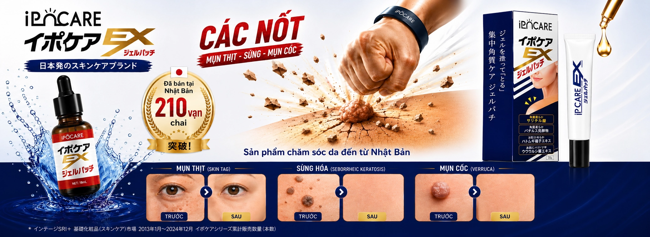 Ipocare